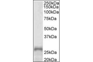 Western Blotting (WB) image for anti-Paired-Like Homeobox 2a (PHOX2A) (AA 165-179), (Internal Region) antibody (ABIN1108647) (PHOX2A 抗体  (Internal Region))