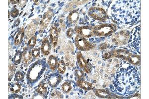 Immunohistochemistry (IHC) image for anti-Pyruvate Kinase, Liver and RBC (PKLR) (N-Term) antibody (ABIN310205) (PKLR 抗体  (N-Term))