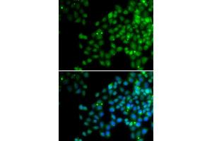 Immunofluorescence analysis of HeLa cell using EPC1 antibody. (EPC1 抗体)