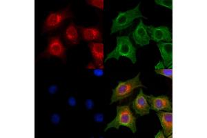 ABIN7094414 and ABIN7098461 staining HepG2 cells by IF/ICC. (OGDHL 抗体  (Internal Region))