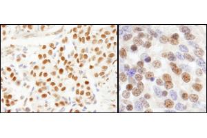 Immunohistochemistry (IHC) image for anti-Splicing Factor 3a, Subunit 1 (SF3A1) (AA 300-350) antibody (ABIN7454762)