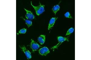 IF analysis of TFEB using anti-TFEB antibody (ABIN7600648). (TFEB 抗体  (AA 214-326))