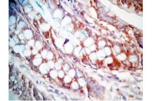 Human colon tissue was stained by Rabbit Anti-CCK (26-33)  (Human,Rat) Antibody (Cholecystokinin 抗体  (non-sulfated))
