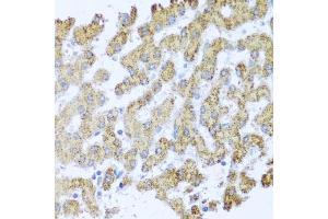 Immunohistochemistry of paraffin-embedded human liver using MOK antibody (ABIN3022550, ABIN3022551, ABIN3022552 and ABIN6218895) at dilution of 1:100 (40x lens). (MOK 抗体  (AA 1-230))
