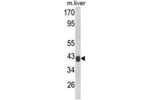 Western blot analysis of TOB1 Antibody (N-term) Cat. (Protein Tob1 (TOB1) (AA 61-91), (N-Term) 抗体)