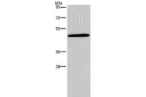 Western Blot analysis of 293T cell using Glucagon Receptor Polyclonal Antibody at dilution of 1:200 (Glucagon Receptor 抗体)