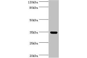Western blot All lanes: Arginase-1 antibody at 8 μg/mL + Mouse liver tissue Secondary Goat polyclonal to rabbit IgG at 1/10000 dilution Predicted band size: 35, 36, 26 kDa Observed band size: 35 kDa (Liver Arginase 抗体  (AA 1-322))