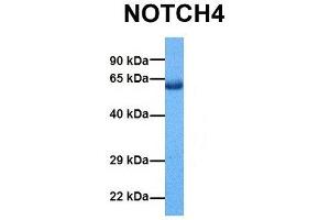 Host:  Rabbit  Target Name:  NOTCH4  Sample Tissue:  Human Lung Tumor  Antibody Dilution:  1. (NOTCH4 抗体  (Middle Region))