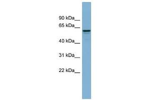 Dynactin 4 antibody used at 1 ug/ml to detect target protein. (Dynactin 4 抗体)