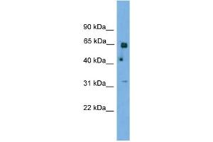 WB Suggested Anti-PNKP Antibody Titration: 1. (PNKP 抗体  (N-Term))