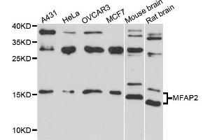 Western blot analysis of extract of various cells, using MFAP2 antibody. (MFAP2 抗体)
