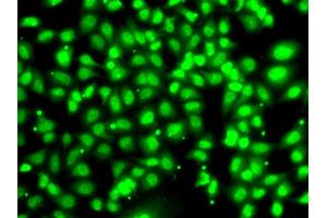 Immunofluorescence analysis of U2OS cells using COPS2 antibody (ABIN5974233). (COPS2 抗体)
