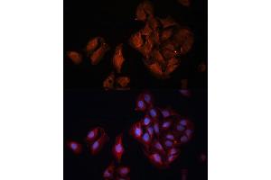 Immunofluorescence analysis of U-2 OS cells using B Polyclonal Antibody (ABIN6131247, ABIN6137447, ABIN6137448 and ABIN6222194) at dilution of 1:100 (40x lens). (BAP1 抗体  (AA 460-729))