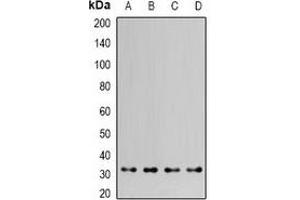 Western blot analysis of HAX1 expression in MCF7 (A), HepG2 (B), mouse kidney (C), mouse brain (D) whole cell lysates. (HAX1 抗体)