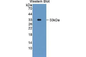Western blot analysis of the recombinant protein. (PKN2 抗体  (AA 67-312))