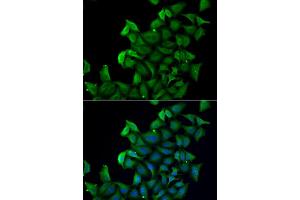 Immunofluorescence analysis of A549 cell using FABP5 antibody. (FABP5 抗体)