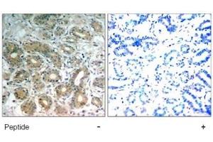 Image no. 1 for anti-Protein tyrosine Phosphatase, Non-Receptor Type 11 (PTPN11) (Tyr542) antibody (ABIN197594)