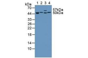 Western Blotting (WB) image for anti-Proteasome (Prosome, Macropain) 26S Subunit, ATPase, 4 (PSMC4) (AA 1-418) antibody (ABIN7442066)