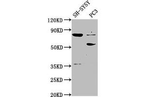 Western Blot Positive WB detected in: SH-SY5Y whole cell lysate, PC-3 whole cell lysate All lanes: ABLIM1 antibody at 1:2000 Secondary Goat polyclonal to rabbit IgG at 1/50000 dilution Predicted band size: 88, 82, 49, 47, 53, 85 kDa Observed band size: 88, 53 kDa (ABLIM1 抗体  (AA 174-319))
