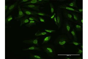 Immunofluorescence of purified MaxPab antibody to YY1 on HeLa cell. (YY1 抗体  (AA 1-414))