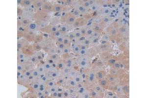 Used in DAB staining on fromalin fixed paraffin- embedded Kidney tissue (SERPINC1 抗体  (AA 1-259))