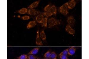 Immunofluorescence analysis of NIH/3T3 cells using CYP11A1 Polyclonal Antibody at dilution of 1:100. (CYP11A1 抗体)