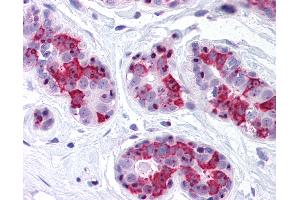 Anti-BAG5 antibody IHC of human breast. (BAG5 抗体)