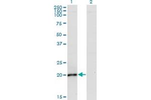 Western Blot analysis of IL6 expression in transfected 293T cell line by IL6 monoclonal antibody (M02), clone 2D12. (IL-6 抗体  (AA 29-212))