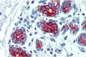Immunohistochemistry staining of human breast (paraffin-embedded sections) with anti-cytokeratin 7+17. (Keratin 7/17 抗体)