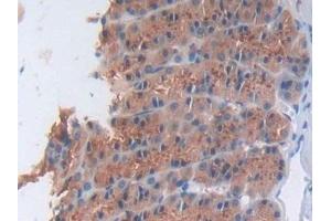 Immunohistochemistry (IHC) image for anti-NADPH Oxidase 1 (NOX1) (AA 291-544) antibody (ABIN7432022)