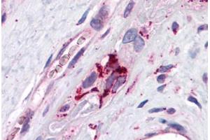 Human Placenta: Formalin-Fixed, Paraffin-Embedded (FFPE) (ADRP 抗体  (AA 28-281))