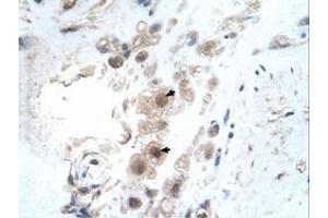Immunohistochemical staining (Formalin-fixed paraffin-embedded sections) of human placenta with KIAA0494 polyclonal antibody  at 4-8 ug/mL working concentration. (KIAA0494 抗体  (N-Term))