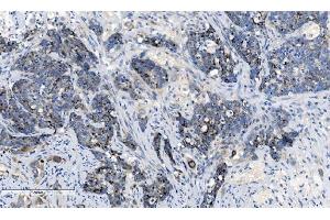 IHC analysis of CHCHD10 using anti-CHCHD10 antibody (ABIN7602507). (CHCHD10 抗体  (AA 80-142))