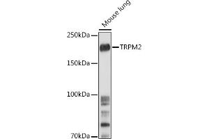 Western Blotting (WB) image for anti-Transient Receptor Potential Cation Channel, Subfamily M, Member 2 (TRPM2) (AA 900-1000) antibody (ABIN6149582)