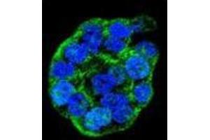Confocal immunofluorescent analysis of WTIP Antibody (C-term) with WiDr cell followed by Alexa Fluor 488-conjugated goat anti-rabbit lgG (green). (WTIP 抗体  (C-Term))