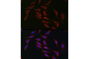 Immunofluorescence (IF) image for anti-Eukaryotic Translation Initiation Factor 4A1 (EIF4A1) (AA 1-406) antibody (ABIN6140076)