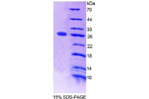 SDS-PAGE analysis of Mouse SNAP23 Protein. (SNAP23 蛋白)