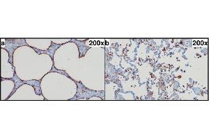 SP-A immunohistochemistry. (Surfactant Protein A1 抗体  (Internal Region))