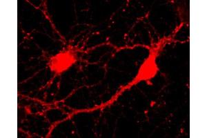 Immunocytochemistry on cultured hippocampus neurons (dilution 1 : 500).