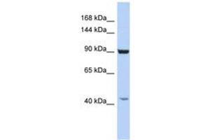 Image no. 1 for anti-Glutamate Receptor Interacting Protein 1 (GRIP1) (AA 950-999) antibody (ABIN6742282) (GRIP1 抗体  (AA 950-999))