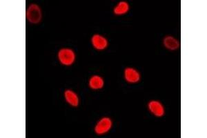 Immunofluorescent analysis of Adenylate Kinase 6 staining in Jurkat cells. (TAF9 抗体  (N-Term))