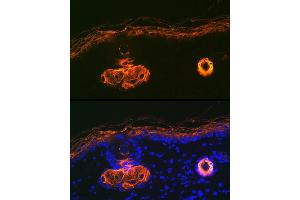 Immunofluorescence analysis of rat skin using Cytokeratin 2e (KRT2) Rabbit mAb (ABIN1680763, ABIN3016322, ABIN3016323 and ABIN7101480) at dilution of 1:100 (40x lens). (Keratin 2 抗体)