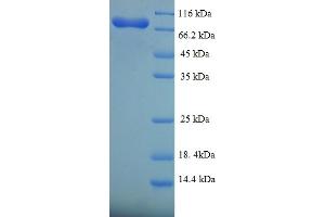 SDS-PAGE (SDS) image for Fanconi Anemia, Complementation Group C (FANCC) (AA 1-558), (full length) protein (His-SUMO Tag) (ABIN4975857) (FANCC Protein (AA 1-558, full length) (His-SUMO Tag))