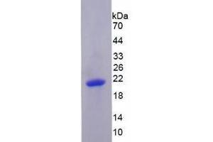SDS-PAGE analysis of Human PRDM1 Protein. (PRDM1 蛋白)