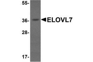 Western blot analysis of ELOVL7 in human liver tissue lysate with AP30312PU-N ELOVL7 antibody at 1 μg/ml. (ELOVL7 抗体  (N-Term))