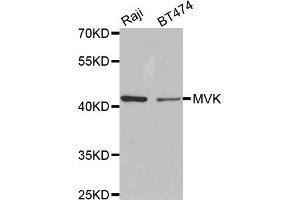 Western blot analysis of extracts of various cell lines, using MVK antibody. (MVK 抗体)