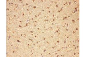 IHC-P: CNTF antibody testing of mouse brain tissue (CNTF 抗体  (AA 2-198))