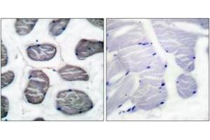 Immunohistochemistry analysis of paraffin-embedded human muscle tissue, using Actin-alpha-1 Antibody. (Actin 抗体  (AA 1-50))