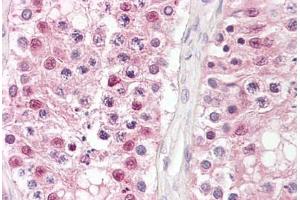 Anti-CSNK2A1 / CKII antibody IHC staining of human testis. (CSNK2A1/CK II alpha 抗体)