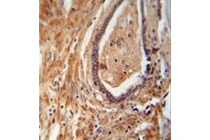 Immunohistochemistry (Paraffin-embedded Sections) (IHC (p)) image for anti-NADH Dehydrogenase (Ubiquinone) 1 alpha Subcomplex, Assembly Factor 1 (NDUFAF1) (AA 250-280), (C-Term) antibody (ABIN953630)